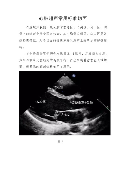 心脏超声常用标准切面图解