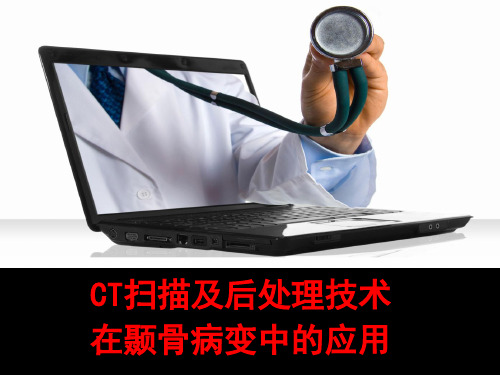 CT扫描及后处理技术在颞骨病变中的应用