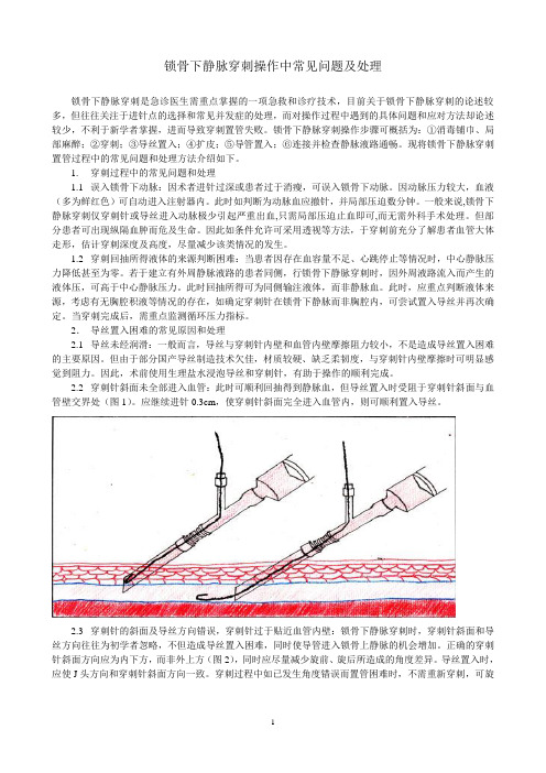 锁骨下静脉穿刺常见问题及处理