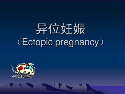 异位妊娠(Ectopic+pregnancy)