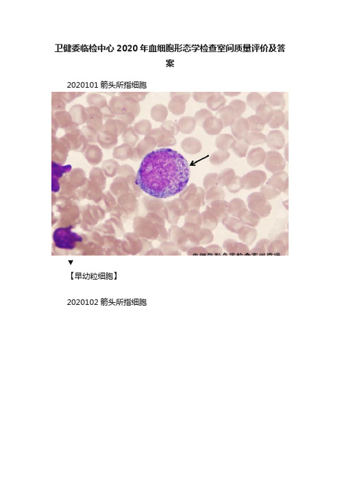 卫健委临检中心2020年血细胞形态学检查室间质量评价及答案