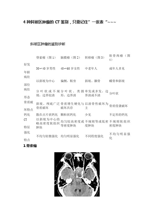 4种斜坡区肿瘤的CT鉴别，只需记住”一张表“~~~