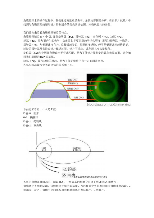 角膜塑形镜