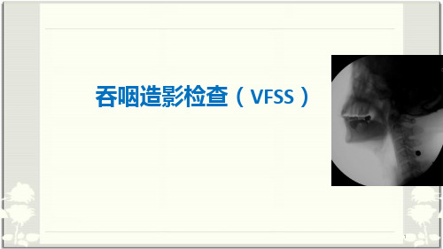 (医学课件)吞咽造影检查(VFSS)