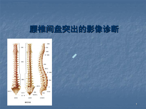 腰椎间盘突出的影像诊断ppt课件