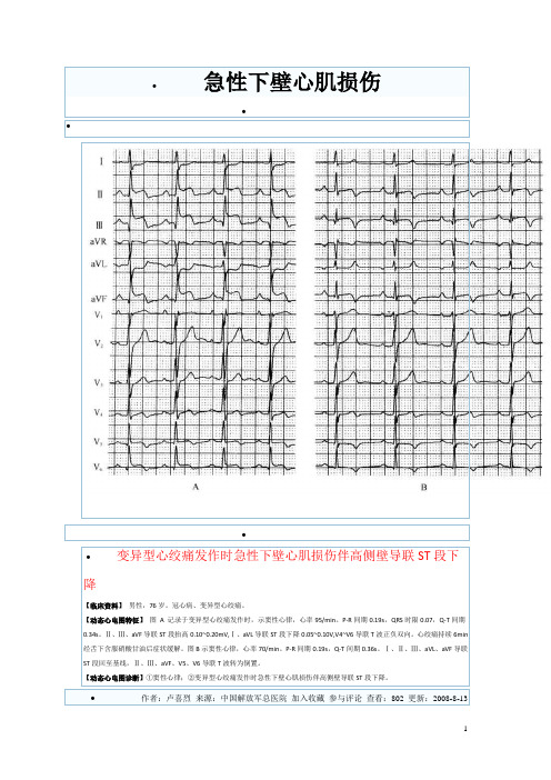 心电图谱17