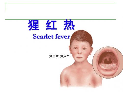 第三章 第六节猩红热