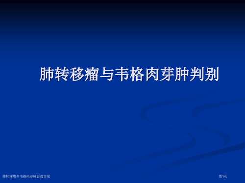 肺转移瘤和韦格肉芽肿影像鉴别专家讲座