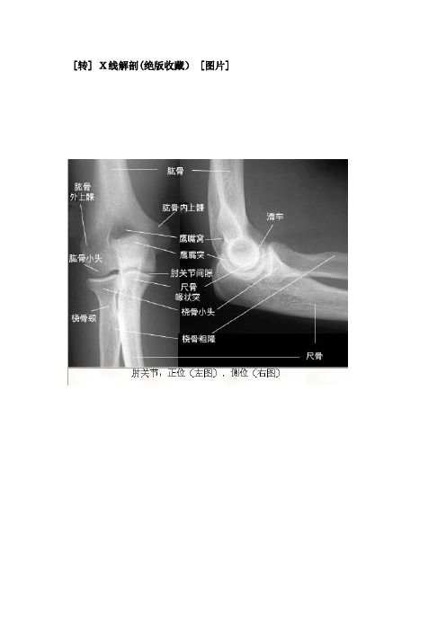 X线解剖(绝版收藏)