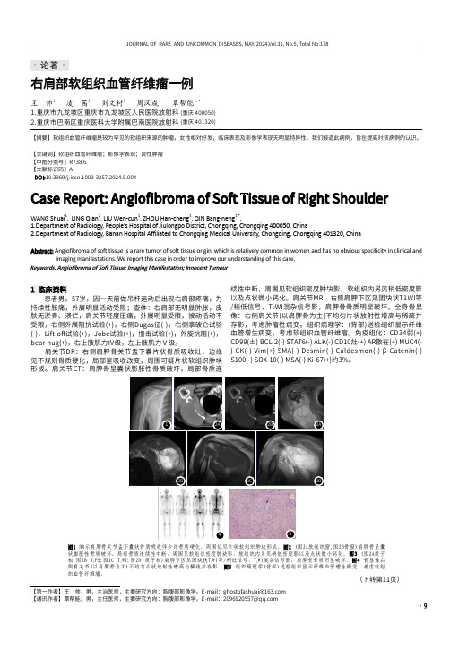 右肩部软组织血管纤维瘤一例