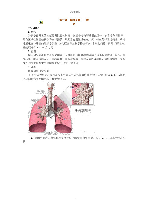 病例分析——肺癌