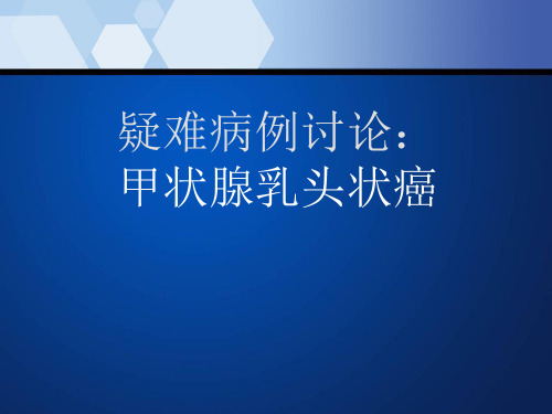 病例讨论甲状腺乳头状癌