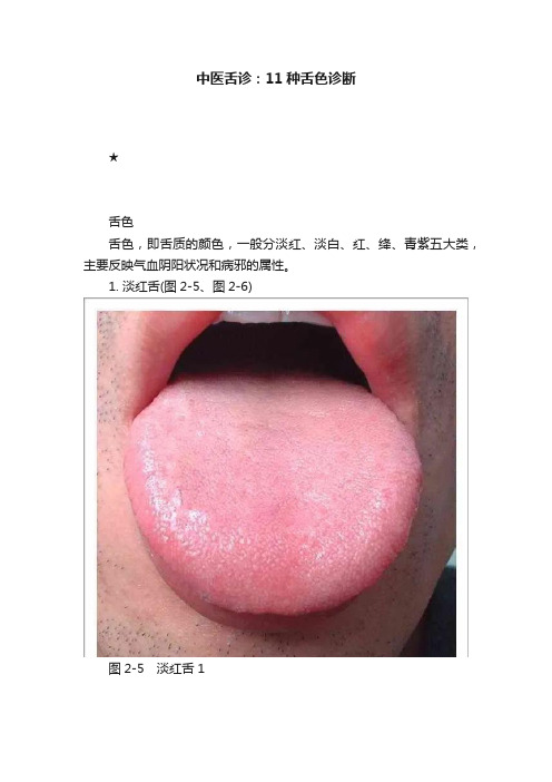 中医舌诊：11种舌色诊断