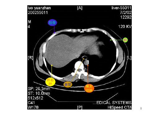 腹部CT解剖图示课堂PPT
