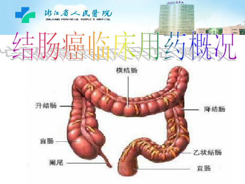 结肠癌Microsoft PowerPoint 演示文稿(6)