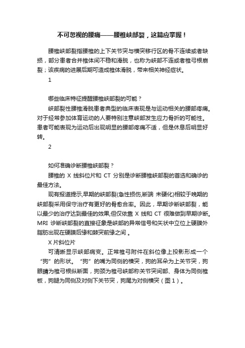 不可忽视的腰痛——腰椎峡部裂，这篇应掌握！