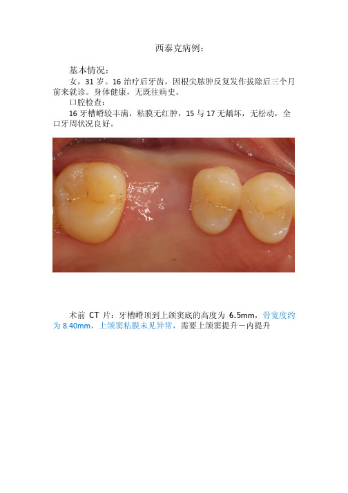 C-Tech单颗种植病例2