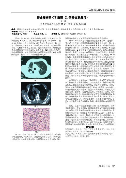 肺曲霉病的CT表现(1例并文献复习)