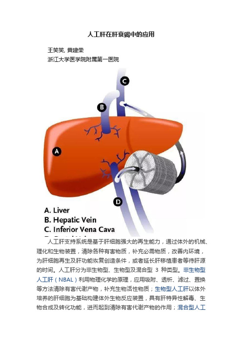 人工肝在肝衰竭中的应用