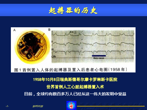 永久心脏起搏器基础