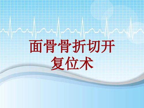 外科手术教学资料：面骨骨折切开复位术讲解模板