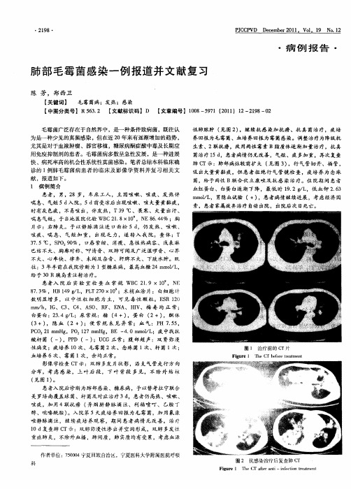 肺部毛霉菌感染一例报道并文献复习