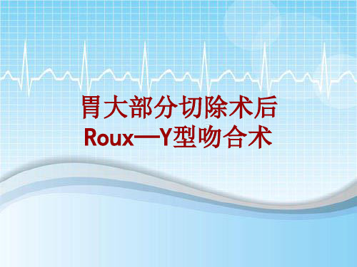 手术讲解模板：胃大部分切除术后Roux—Y型吻合术