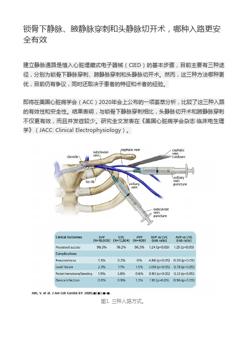 锁骨下静脉、腋静脉穿刺和头静脉切开术,哪种入路更安全有效