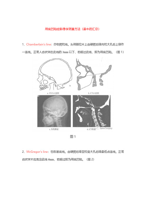 颅底凹陷症影像学测量方法(最牛的汇总)