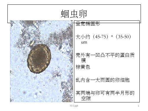 寄生虫学虫卵总结及图片1ppt课件