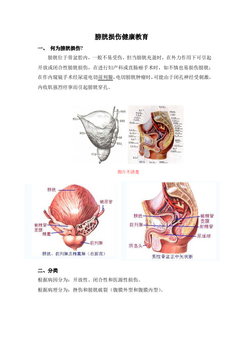 膀胱损伤健康教育