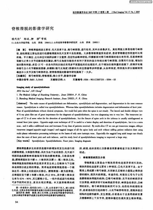 脊椎滑脱的影像学研究