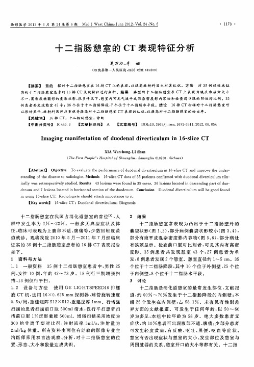 十二指肠憩室的CT表现特征分析