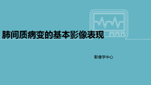 肺间质性病变的影像表现