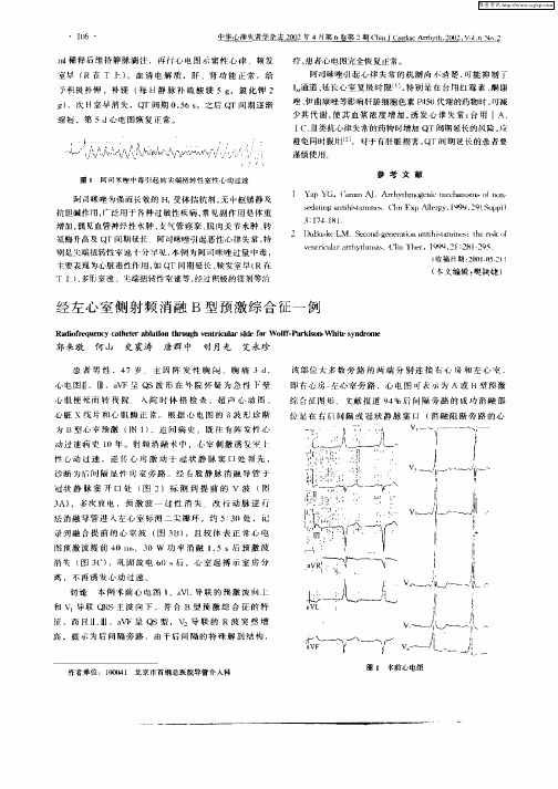 经左心室侧射频消融B型预激综合征一例