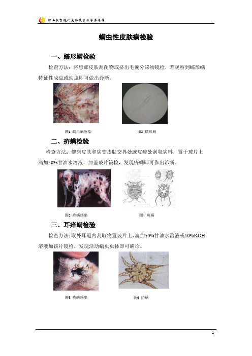 皮肤病检查--螨虫性皮肤病检验.