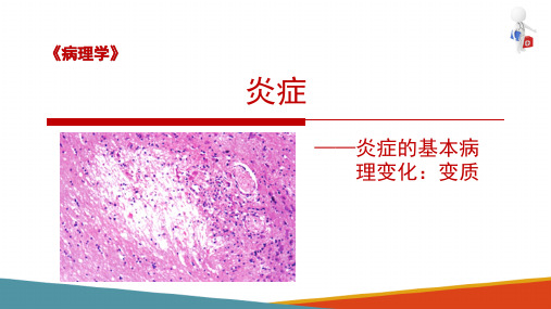 炎症的基本病理变化—变质(病理学课件)