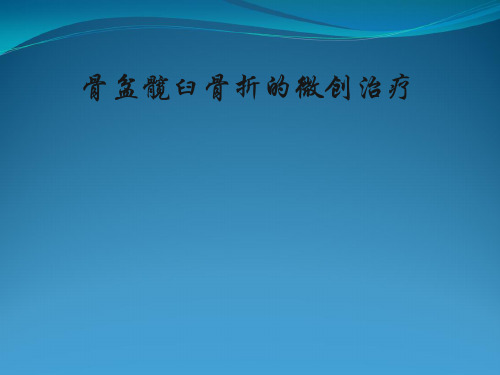 骨盆髋臼骨折微创治疗