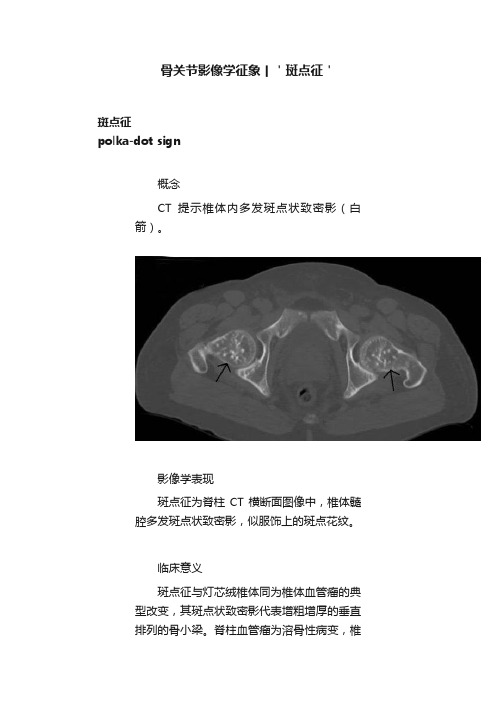 骨关节影像学征象丨＇斑点征＇