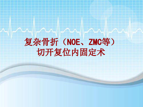 手术讲解模板：复杂骨折(NOE、ZMC等)切开复位内固定术