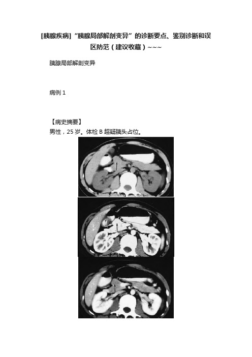 [胰腺疾病]“胰腺局部解剖变异”的诊断要点、鉴别诊断和误区防范（建议收藏）~~~