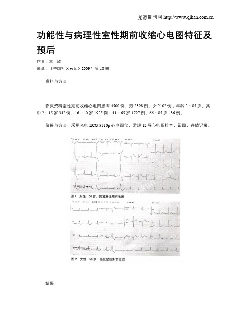 功能性与病理性室性期前收缩心电图特征及预后