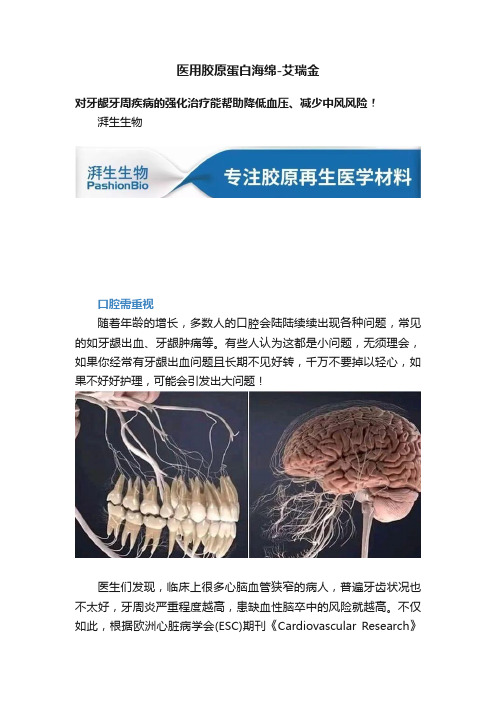 医用胶原蛋白海绵-艾瑞金