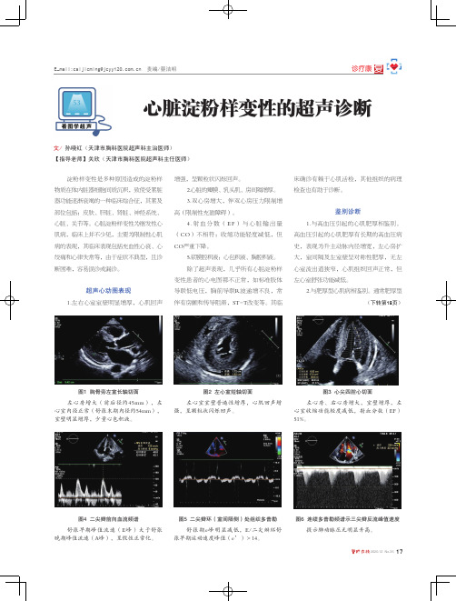 心脏淀粉样变性的超声诊断