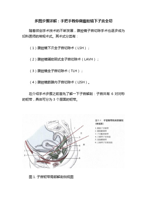 多图步骤详解：手把手教你做腹腔镜下子宫全切