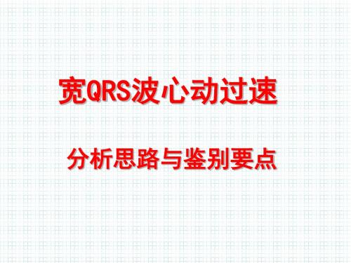 宽QRS心动过速分析思路与鉴别要点医学课件