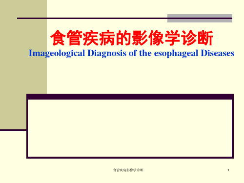 食管疾病影像学诊断ppt课件