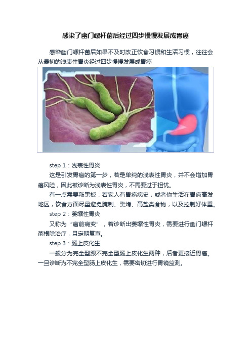 感染了幽门螺杆菌后经过四步慢慢发展成胃癌