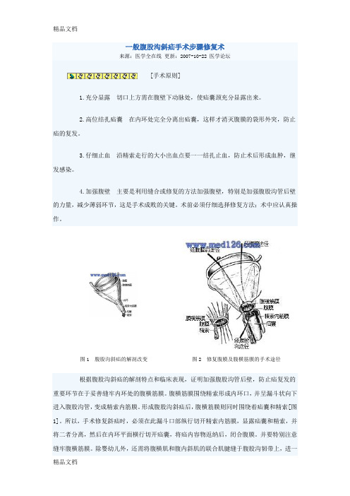 (整理)一般腹股沟斜疝手术步骤修复术.