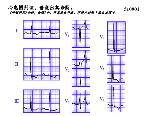 执业医师实践技能考核三心电图试题集ppt课件